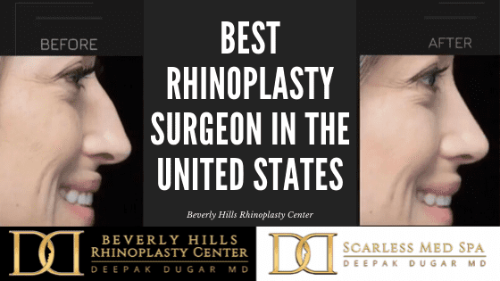 best rhinoplasty surgeon in the united states text in between a before and after photo of a female scarless rhinoplasty patient