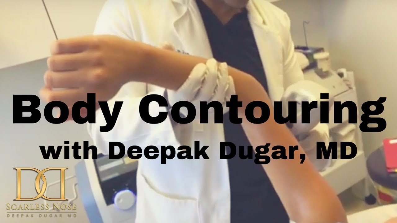 Dr Deepak Dugar doing a non-surgical body contouring to his female patient's arm